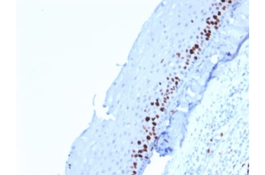 Immunohistochemistry (formalin-fixed, paraffin-embedded) - Anti-Ki67 Antibody [MKI67/2462] (Biotin) (A353988) - Antibodies.com