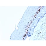 Immunohistochemistry (formalin-fixed, paraffin-embedded) - Anti-Ki67 Antibody [MKI67/2462] (Biotin) (A353988) - Antibodies.com