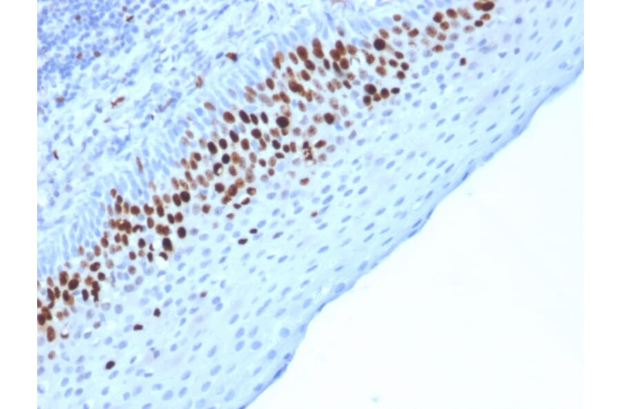 Immunohistochemistry (formalin-fixed, paraffin-embedded) - Anti-Ki67 Antibody [MKI67/2463] (CF®405S) (A353989) - Antibodies.com