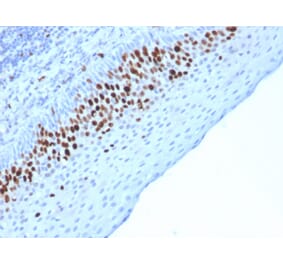 Immunohistochemistry (formalin-fixed, paraffin-embedded) - Anti-Ki67 Antibody [MKI67/2463] (CF®647) (A353991) - Antibodies.com