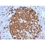 Immunohistochemistry (formalin-fixed, paraffin-embedded) - Anti-Ki67 Antibody [MKI67/2465] (CF®405S) (A353997) - Antibodies.com