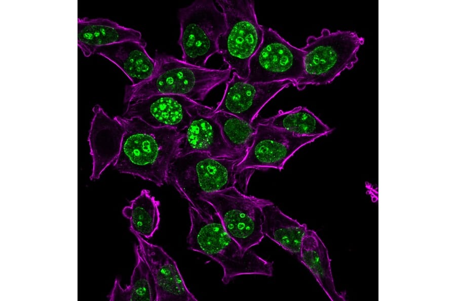 Immunofluorescence - Anti-Ki67 Antibody [MKI67/2465] (CF®640R) (A353998) - Antibodies.com