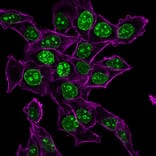 Immunofluorescence - Anti-Ki67 Antibody [MKI67/2465] (CF®640R) (A353998) - Antibodies.com