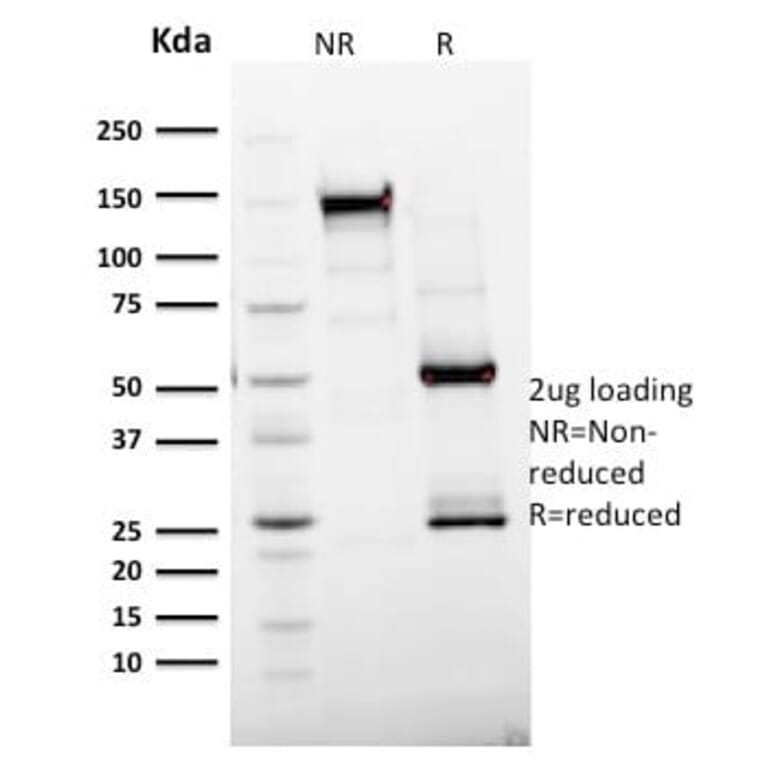 SDS-PAGE - Anti-Ki67 Antibody [MKI67/2465] (CF®640R) (A353998) - Antibodies.com