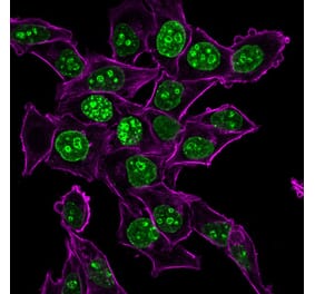 Immunofluorescence - Anti-Ki67 Antibody [MKI67/2465] (CF®568) (A354000) - Antibodies.com