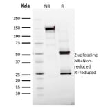 SDS-PAGE - Anti-Ki67 Antibody [MKI67/2465] (CF®568) (A354000) - Antibodies.com