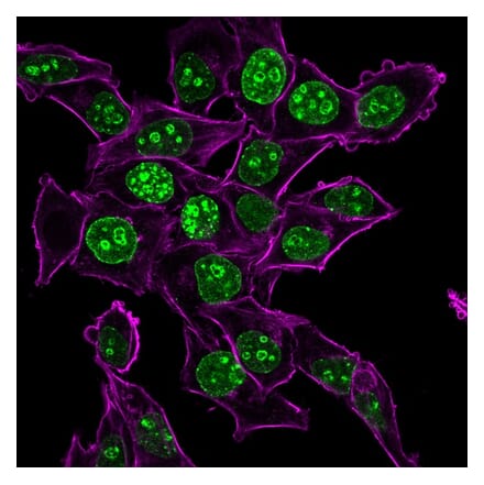 Immunofluorescence - Anti-Ki67 Antibody [MKI67/2465] (CF®488A) (A354002) - Antibodies.com