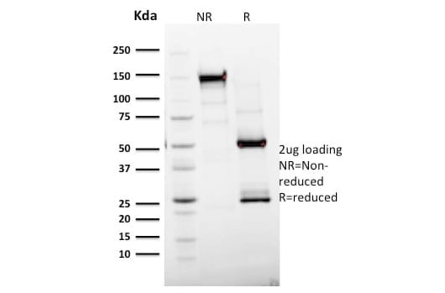 SDS-PAGE - Anti-Ki67 Antibody [MKI67/2465] (CF®594) (A354003) - Antibodies.com
