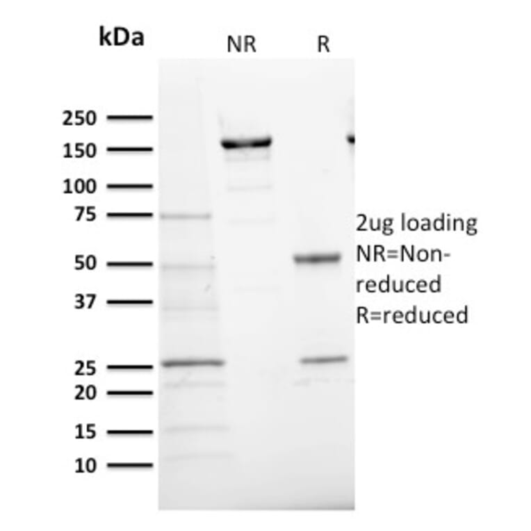 SDS-PAGE - Anti-Ki67 Antibody [MKI67/2466] (CF®568) (A354008) - Antibodies.com