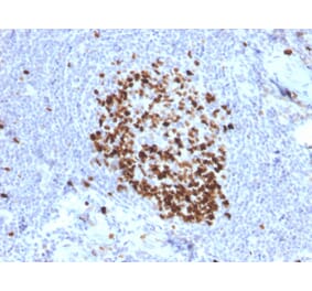 Immunohistochemistry (formalin-fixed, paraffin-embedded) - Anti-Ki67 Antibody [MKI67/2466] (CF®594) (A354011) - Antibodies.com
