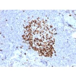 Immunohistochemistry (formalin-fixed, paraffin-embedded) - Anti-Ki67 Antibody [MKI67/2466] (CF®594) (A354011) - Antibodies.com