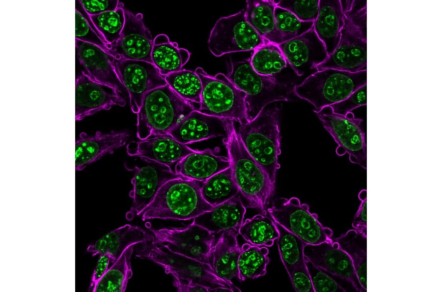 Immunofluorescence - Anti-Ki67 Antibody [MKI67/2466] (CF®594) (A354011) - Antibodies.com