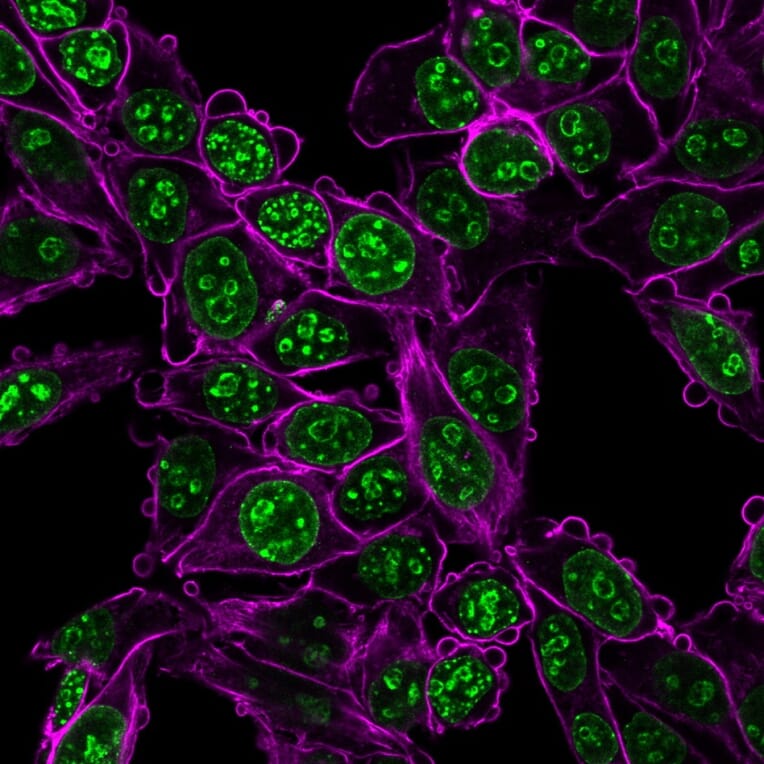 Immunofluorescence - Anti-Ki67 Antibody [MKI67/2466] (CF®594) (A354011) - Antibodies.com