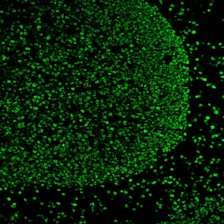 Immunofluorescence - Anti-Ki67 Antibody [MKI67/2466] (CF®594) (A354011) - Antibodies.com