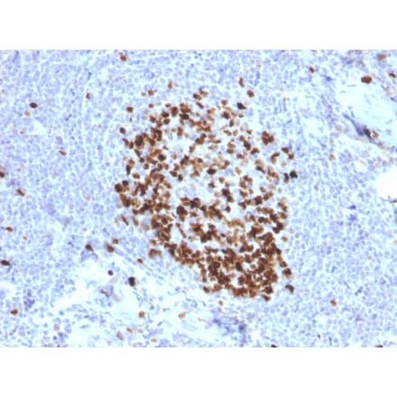 Immunohistochemistry (formalin-fixed, paraffin-embedded) - Anti-Ki67 Antibody [MKI67/2466] (Biotin) (A354012) - Antibodies.com