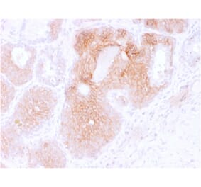 Immunohistochemistry (formalin-fixed, paraffin-embedded) - Anti-CD44v6 Antibody [CD44V6/2496] (CF®640R) (A354014) - Antibodies.com