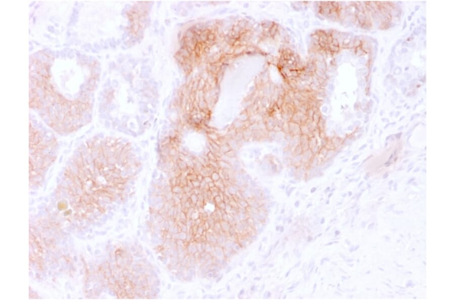 Immunohistochemistry (formalin-fixed, paraffin-embedded) - Anti-CD44v6 Antibody [CD44V6/2496] (CF®740) (A354017) - Antibodies.com