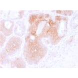 Immunohistochemistry (formalin-fixed, paraffin-embedded) - Anti-CD44v6 Antibody [CD44V6/2496] (CF®740) (A354017) - Antibodies.com