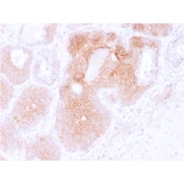 Immunohistochemistry (formalin-fixed, paraffin-embedded) - Anti-CD44v6 Antibody [CD44V6/2496] (CF®488A) (A354018) - Antibodies.com