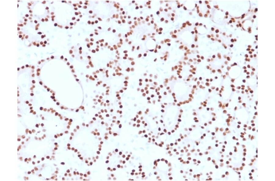 Immunohistochemistry (formalin-fixed, paraffin-embedded) - Anti-Cyclin D1 Antibody [CCND1/2593] (CF®647) (A354031) - Antibodies.com