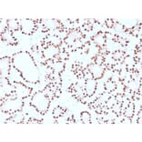 Immunohistochemistry (formalin-fixed, paraffin-embedded) - Anti-Cyclin D1 Antibody [CCND1/2593] (CF®568) (A354032) - Antibodies.com