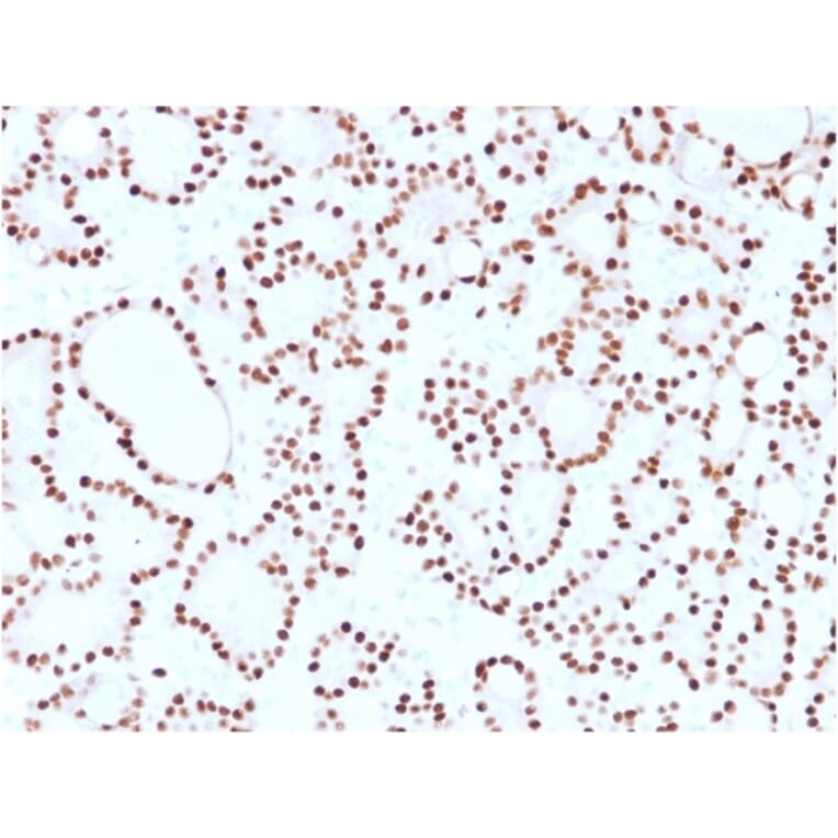 Immunohistochemistry (formalin-fixed, paraffin-embedded) - Anti-Cyclin D1 Antibody [CCND1/2593] (CF®488A) (A354034) - Antibodies.com