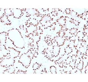 Immunohistochemistry (formalin-fixed, paraffin-embedded) - Anti-Cyclin D1 Antibody [CCND1/2593] (CF®594) (A354035) - Antibodies.com