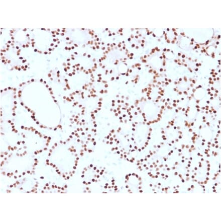 Immunohistochemistry (formalin-fixed, paraffin-embedded) - Anti-Cyclin D1 Antibody [CCND1/2593] (CF®594) (A354035) - Antibodies.com