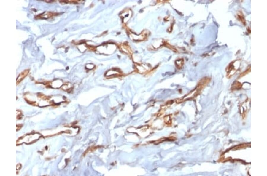 Immunohistochemistry (formalin-fixed, paraffin-embedded) - Anti-CD34 Antibody [HPCA1/2598R] (CF®405S) (A354037) - Antibodies.com