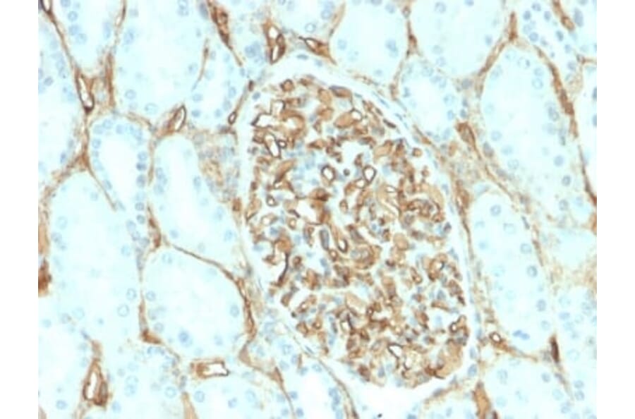 Immunohistochemistry (formalin-fixed, paraffin-embedded) - Anti-CD34 Antibody [HPCA1/2598R] (CF®405S) (A354037) - Antibodies.com