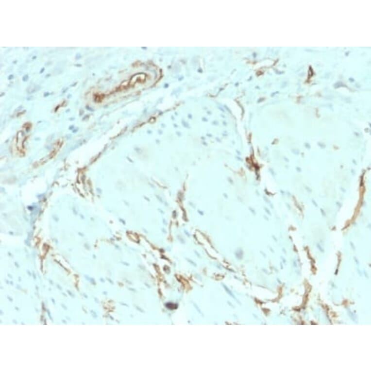 Immunohistochemistry (formalin-fixed, paraffin-embedded) - Anti-CD34 Antibody [HPCA1/2598R] (CF®405S) (A354037) - Antibodies.com