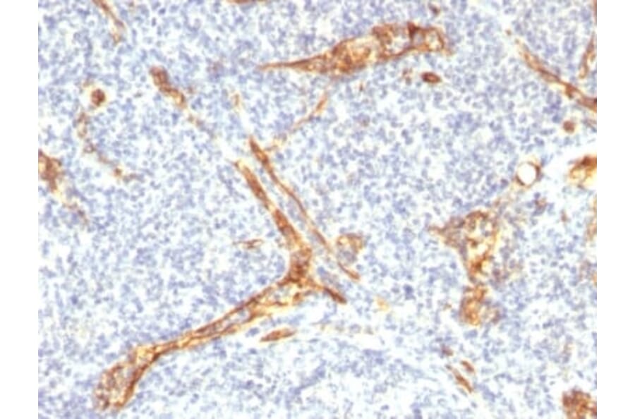 Immunohistochemistry (formalin-fixed, paraffin-embedded) - Anti-CD34 Antibody [HPCA1/2598R] (CF®405S) (A354037) - Antibodies.com
