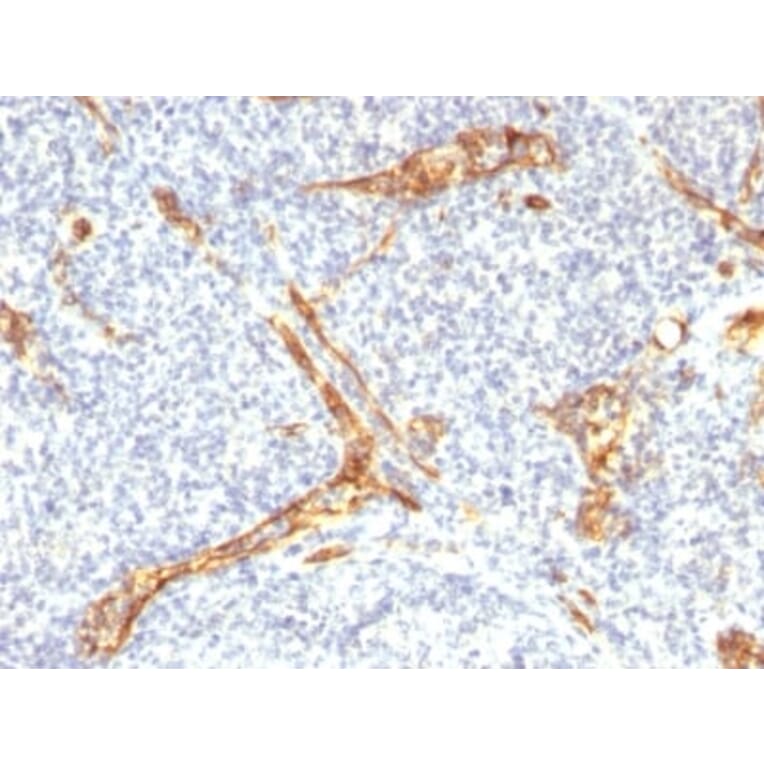 Immunohistochemistry (formalin-fixed, paraffin-embedded) - Anti-CD34 Antibody [HPCA1/2598R] (CF®405S) (A354037) - Antibodies.com