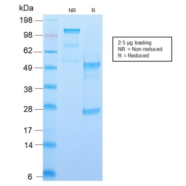 SDS-PAGE - Anti-CD34 Antibody [HPCA1/2598R] (CF®405S) (A354037) - Antibodies.com