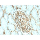 Immunohistochemistry (formalin-fixed, paraffin-embedded) - Anti-CD34 Antibody [HPCA1/2598R] (CF®640R) (A354038) - Antibodies.com