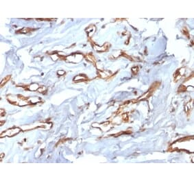 Immunohistochemistry (formalin-fixed, paraffin-embedded) - Anti-CD34 Antibody [HPCA1/2598R] (CF®740) (A354041) - Antibodies.com
