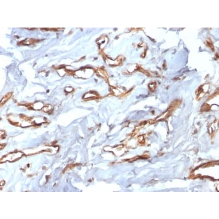 Immunohistochemistry (formalin-fixed, paraffin-embedded) - Anti-CD34 Antibody [HPCA1/2598R] (CF®488A) (A354042) - Antibodies.com
