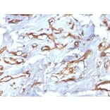 Immunohistochemistry (formalin-fixed, paraffin-embedded) - Anti-CD34 Antibody [HPCA1/2598R] (CF®488A) (A354042) - Antibodies.com