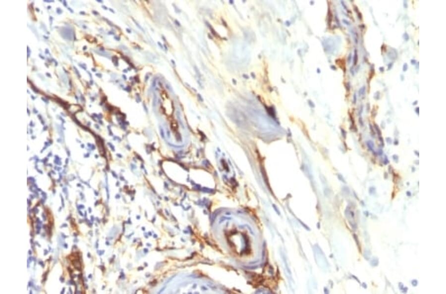 Immunohistochemistry (formalin-fixed, paraffin-embedded) - Anti-CD34 Antibody [HPCA1/2598R] (CF®488A) (A354042) - Antibodies.com