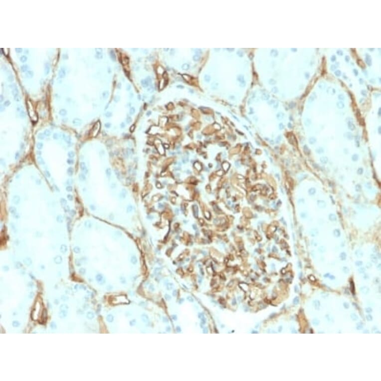 Immunohistochemistry (formalin-fixed, paraffin-embedded) - Anti-CD34 Antibody [HPCA1/2598R] (CF®488A) (A354042) - Antibodies.com