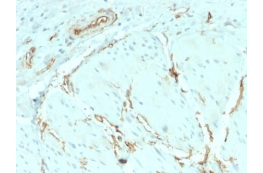 Immunohistochemistry (formalin-fixed, paraffin-embedded) - Anti-CD34 Antibody [HPCA1/2598R] (CF®488A) (A354042) - Antibodies.com