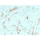 Immunohistochemistry (formalin-fixed, paraffin-embedded) - Anti-CD34 Antibody [HPCA1/2598R] (CF®488A) (A354042) - Antibodies.com