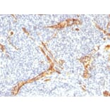 Immunohistochemistry (formalin-fixed, paraffin-embedded) - Anti-CD34 Antibody [HPCA1/2598R] (CF®594) (A354043) - Antibodies.com