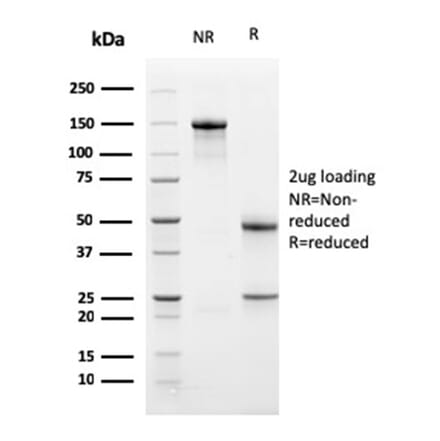 SDS-PAGE - Anti-PD-L1 Antibody [PDL1/2741] (CF®640R) (A354063) - Antibodies.com