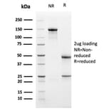 SDS-PAGE - Anti-PD-L1 Antibody [PDL1/2741] (CF®640R) (A354063) - Antibodies.com