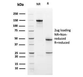 SDS-PAGE - Anti-PD-L1 Antibody [PDL1/2741] (CF®647) (A354064) - Antibodies.com