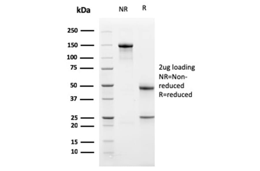 SDS-PAGE - Anti-PD-L1 Antibody [PDL1/2741] (CF®568) (A354065) - Antibodies.com