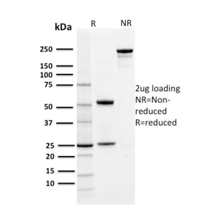 SDS-PAGE - Anti-PD-L1 Antibody [PDL1/2742] (CF®640R) (A354071) - Antibodies.com