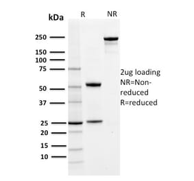 SDS-PAGE - Anti-PD-L1 Antibody [PDL1/2742] (CF®568) (A354073) - Antibodies.com