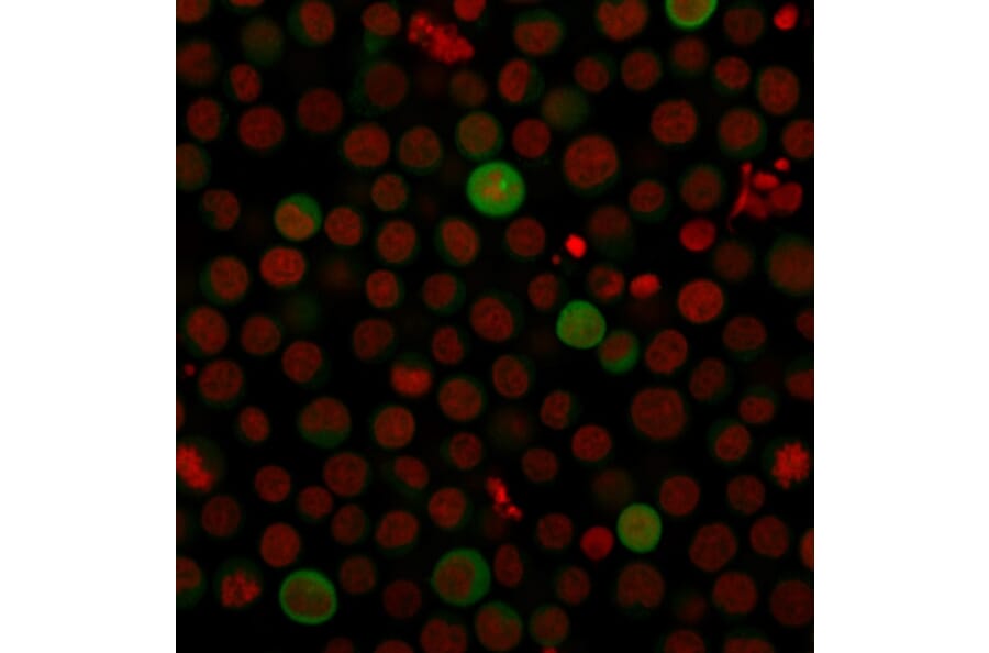Immunofluorescence - Anti-PD-L1 Antibody [PDL1/2743] (CF®640R) (A354079) - Antibodies.com
